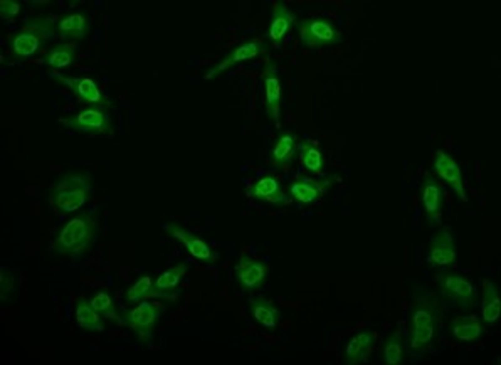 Anti-E2F4 Rabbit Monoclonal Antibody [clone: 24000000000000] | VWR ...