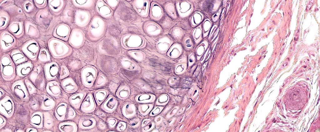 Elastic Cartilage, Rabbit Slide
