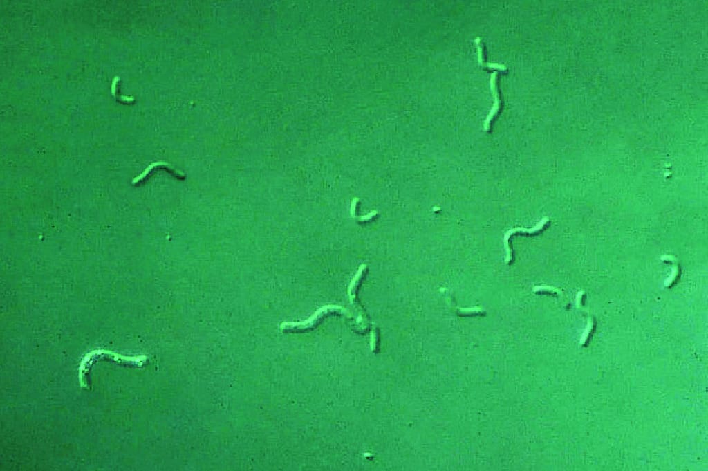 Ward's® Live Aquaspirillium serpens Culture