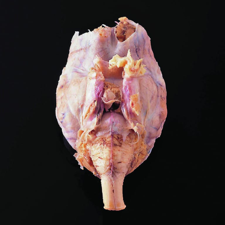 Single Injected Sheep Brain