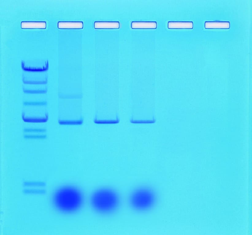 Mini-Prep Isolation of Plasmid DNA
