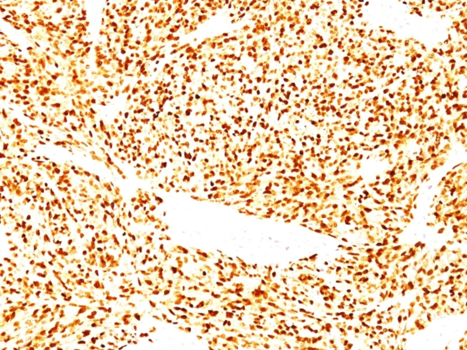 Anti-MyoD1 Mouse Monoclonal Antibody [clone: SPM427] | VWR, part of Avantor