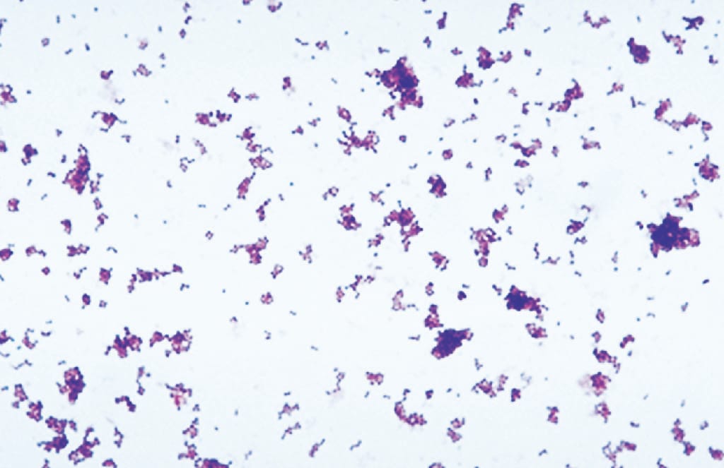 Ward's® Live Corynebacterium xerosis Culture