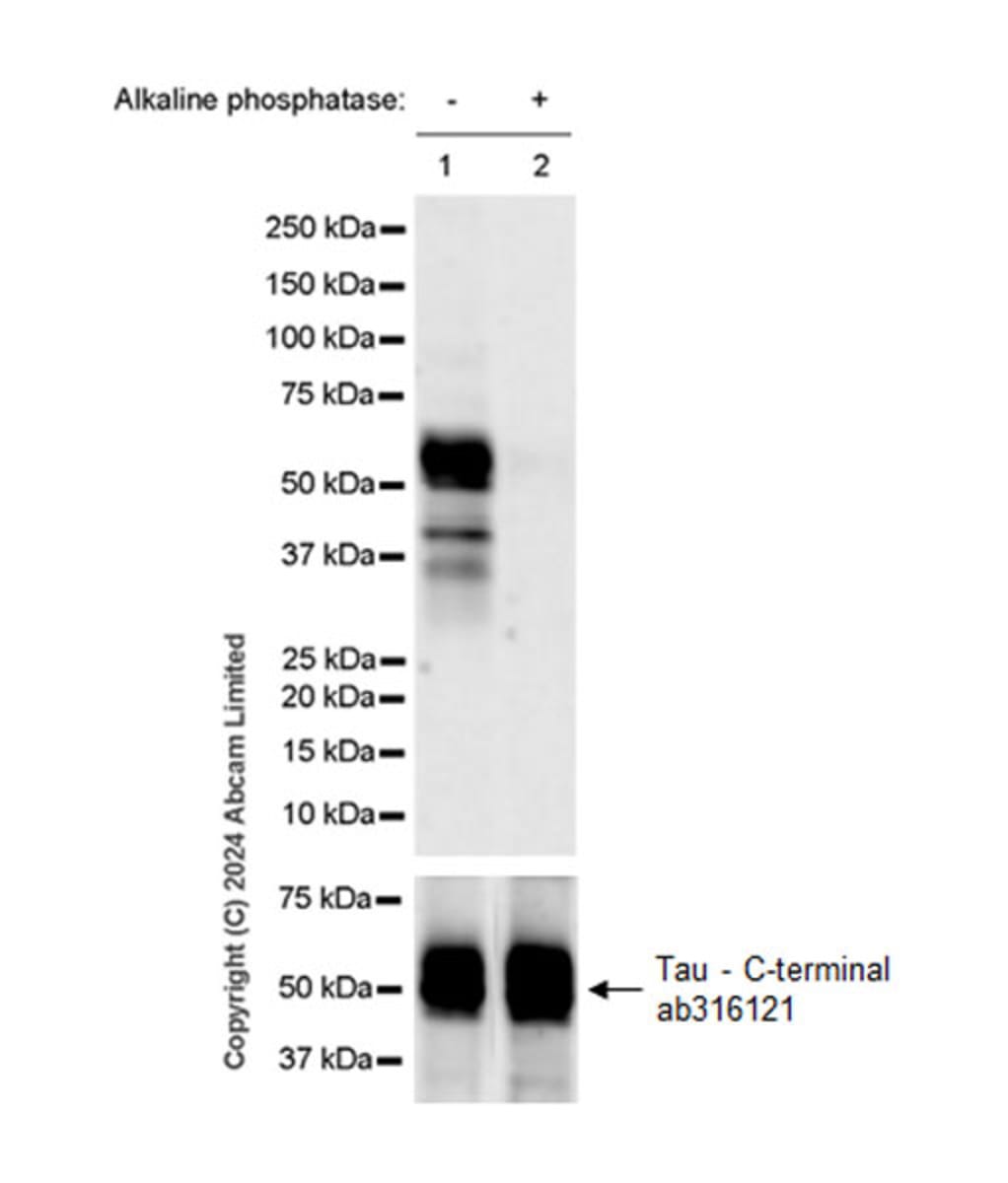 Anti-Tau phospho T50 Rabbit Monoclonal Antibody [clone: EPR29148-44 ...