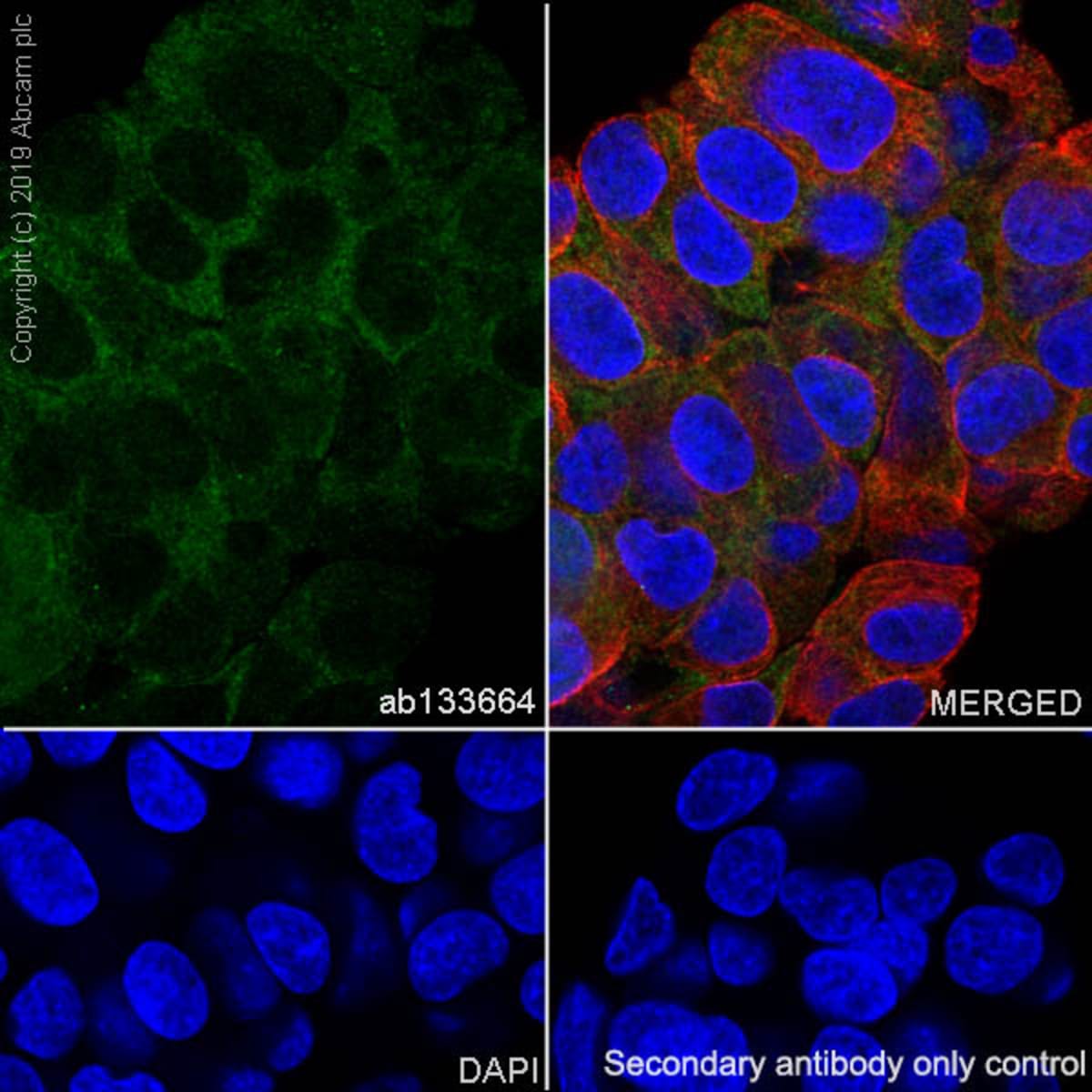 Anti-ACSS2 Rabbit Monoclonal Antibody [clone: EPR8500] | VWR, part of ...