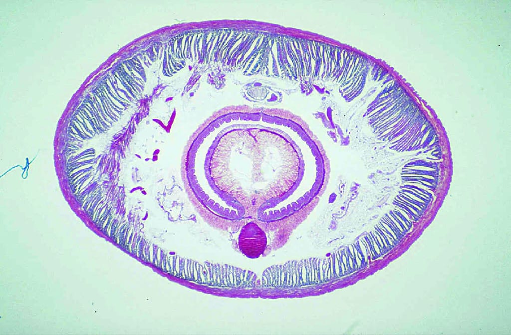 Earthworm, (Lumbricus terrestris), Through Posterior Slide