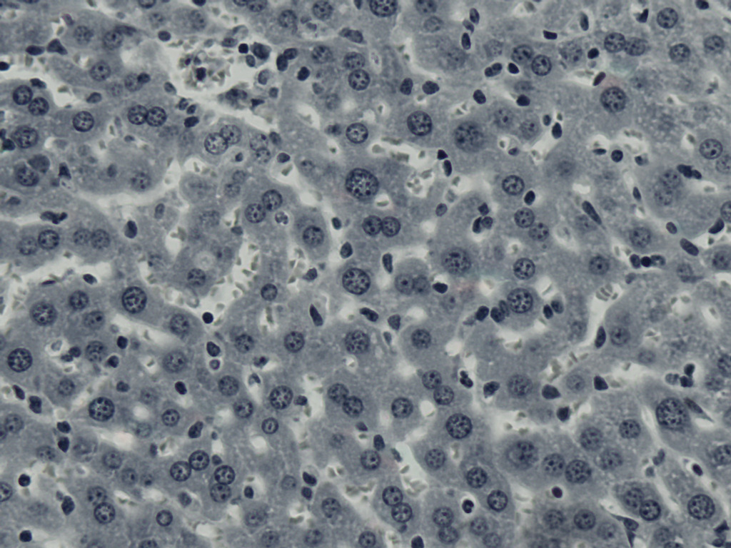 Toxoplasma gondii, Liver Slide