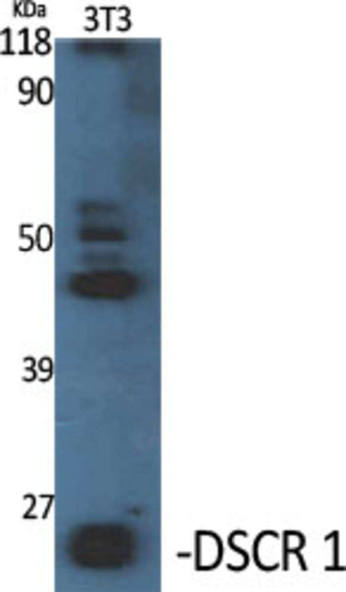 Anti-Calcipressin 1 Rabbit Polyclonal Antibody | VWR, part of Avantor