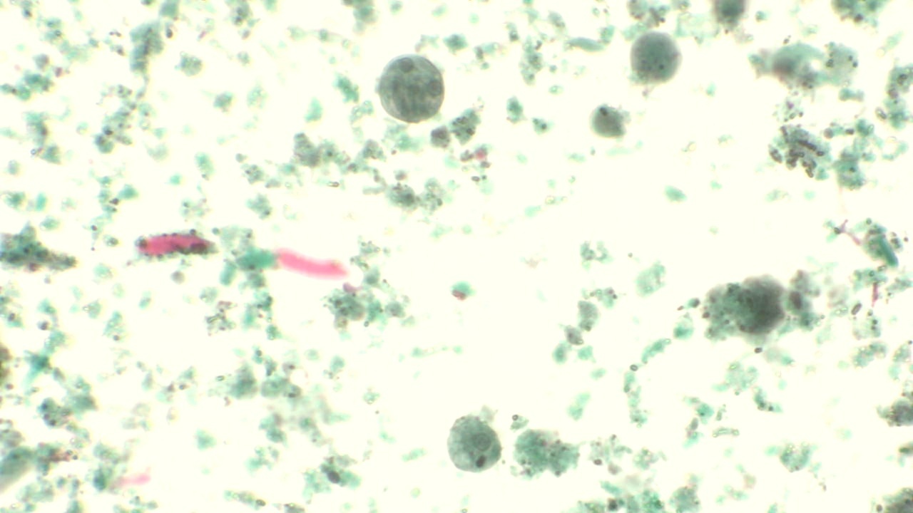 Entamoeba coli, Trophozoites Slide