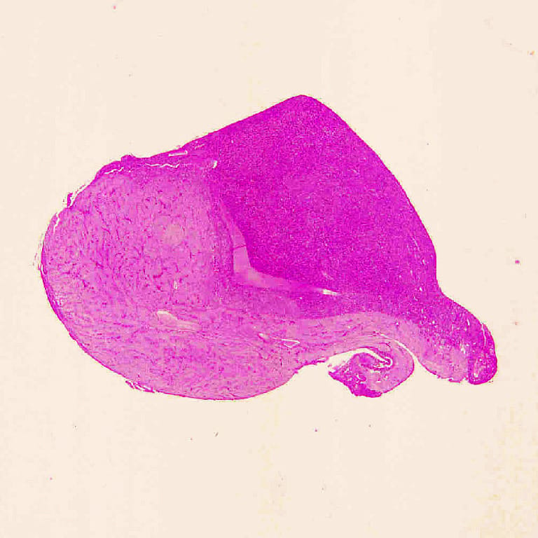 Pituitary Gland Slide