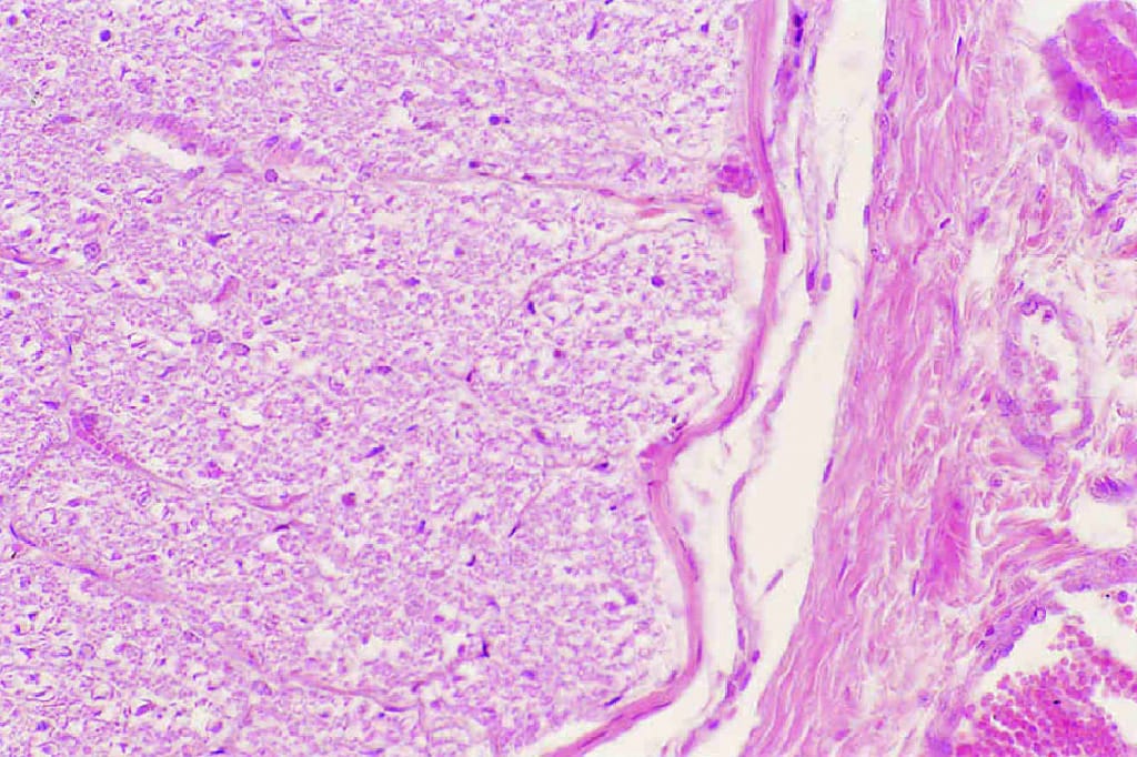 Optic Nerve Slide
