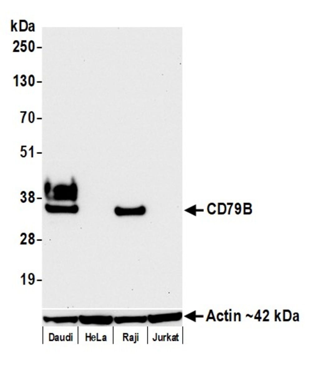 Anti-CD79b Rabbit Monoclonal Antibody [clone: BLR229K] | VWR, part of ...