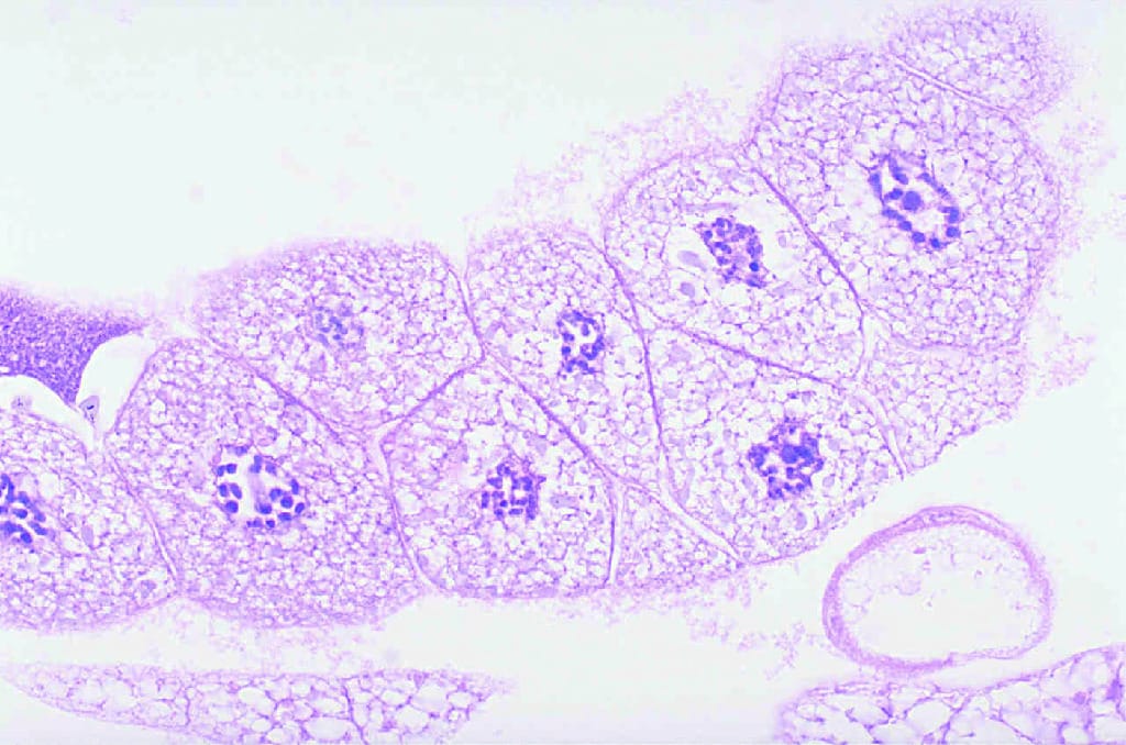 Drosophila Chromosomes Slide