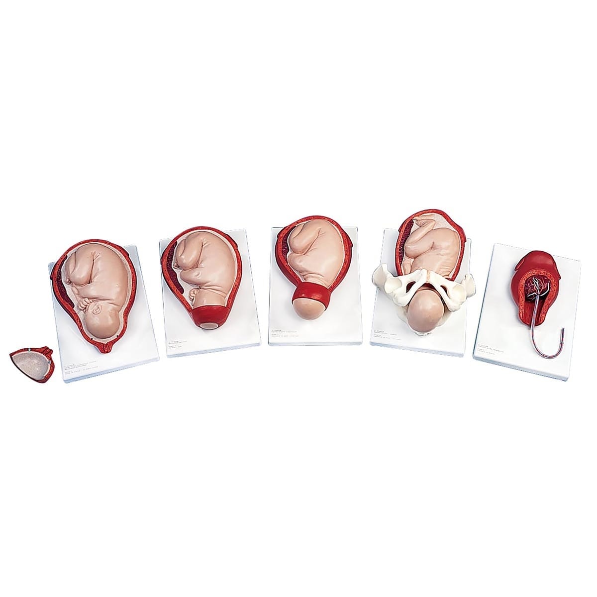 3B Scientific® Stages Of The Birthing Process