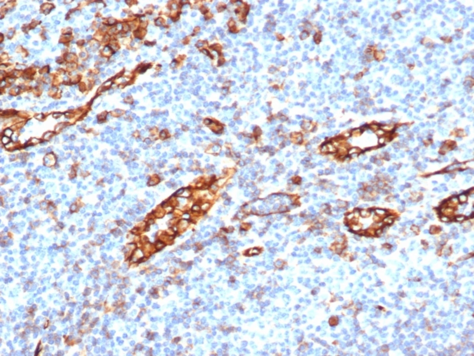 Anti-CD31 Rabbit Recombinant Antibody [clone: C31/6446R] | VWR, part of ...