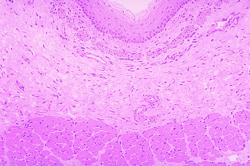Esophagus Slide