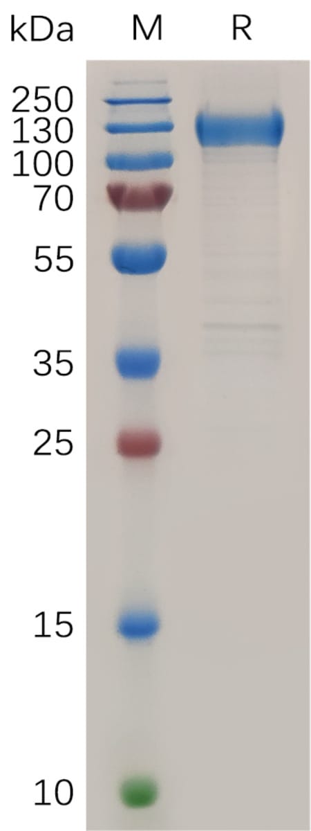Human Recombinant VEGF Receptor 1 (from HEK293 Cells) | VWR, part of ...