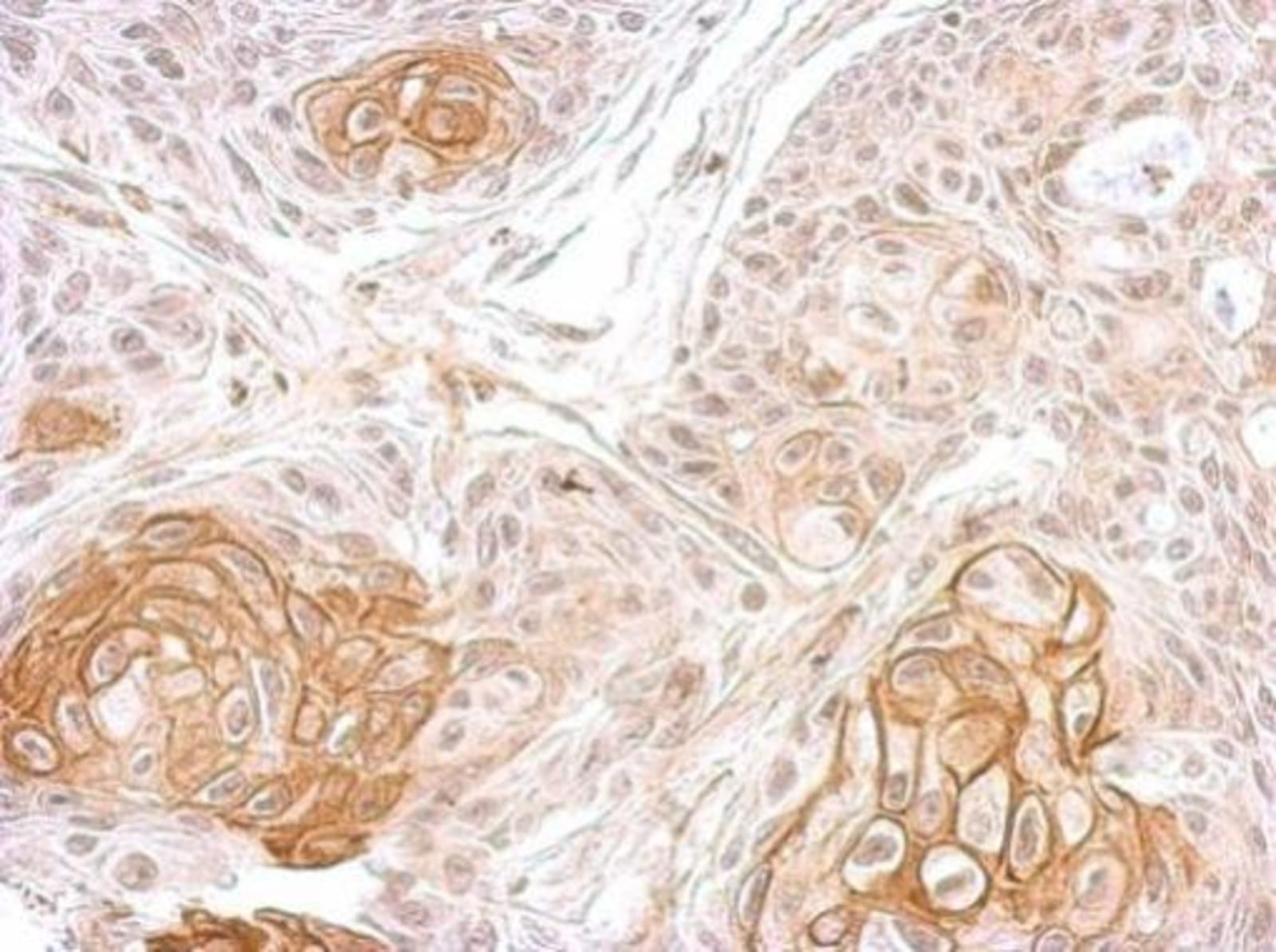 Anti-ATP1B1 Rabbit Polyclonal Antibody | VWR, part of Avantor