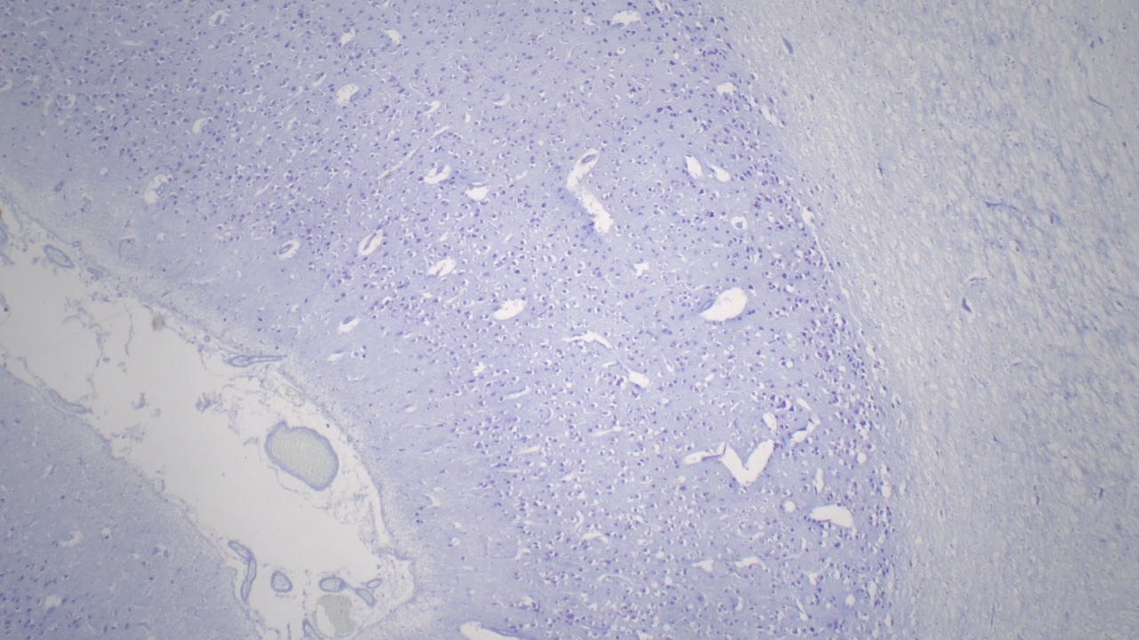 Cerebrum, Mammal Slide