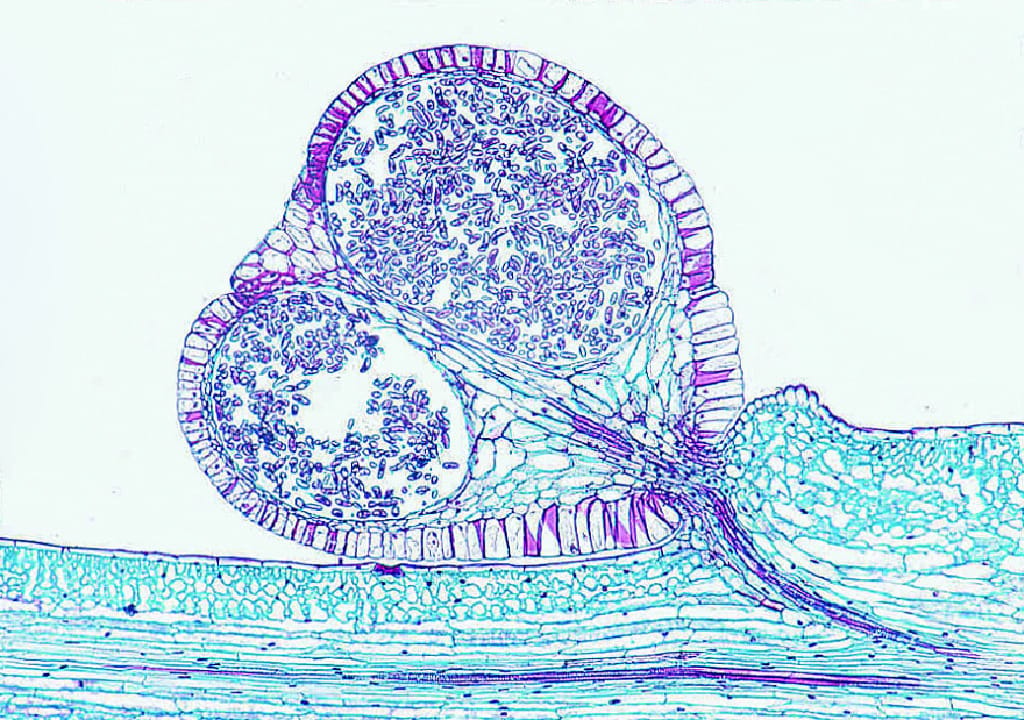 Psilotum, Stem and Sporangia Slide