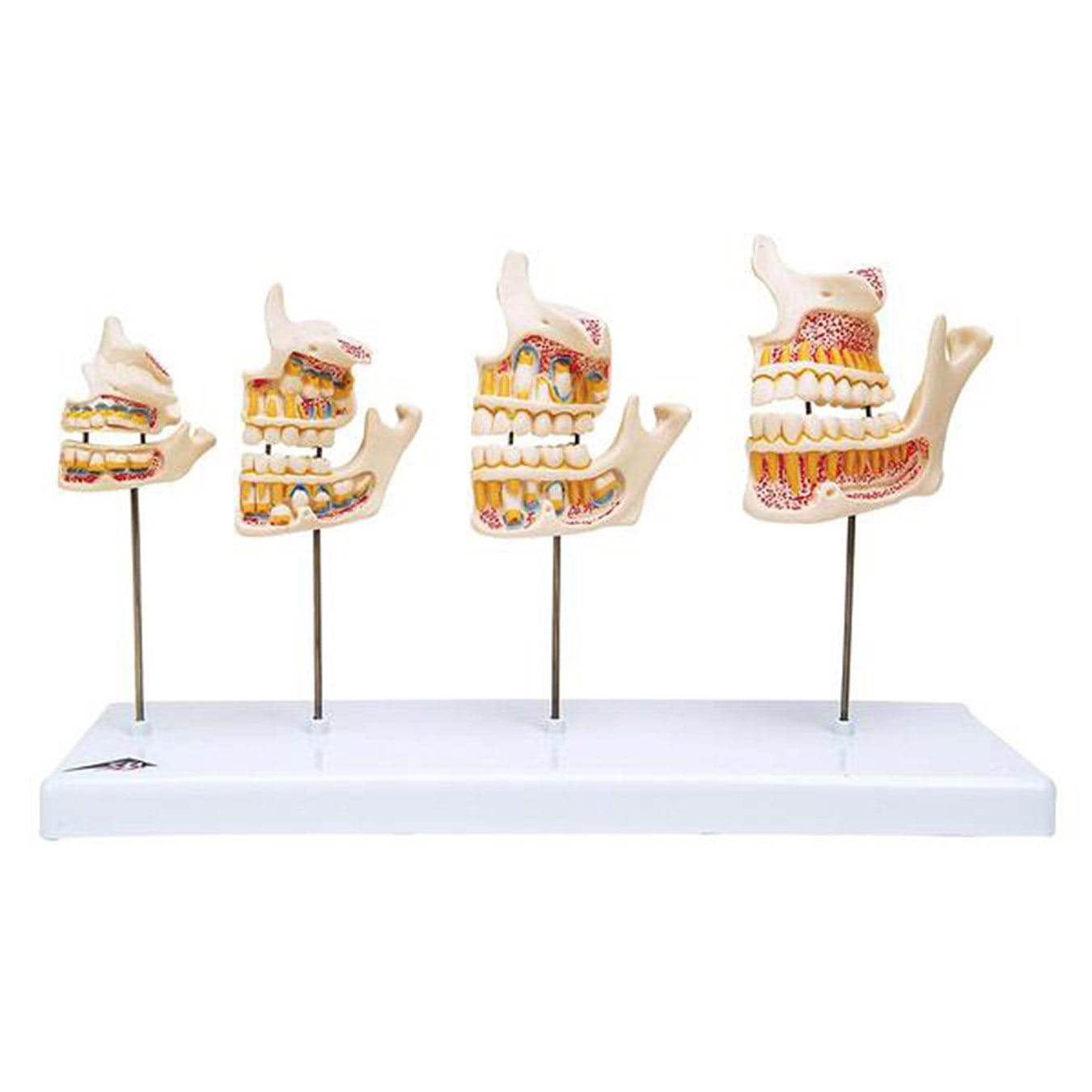 3B Scientific® Dentition Development Set