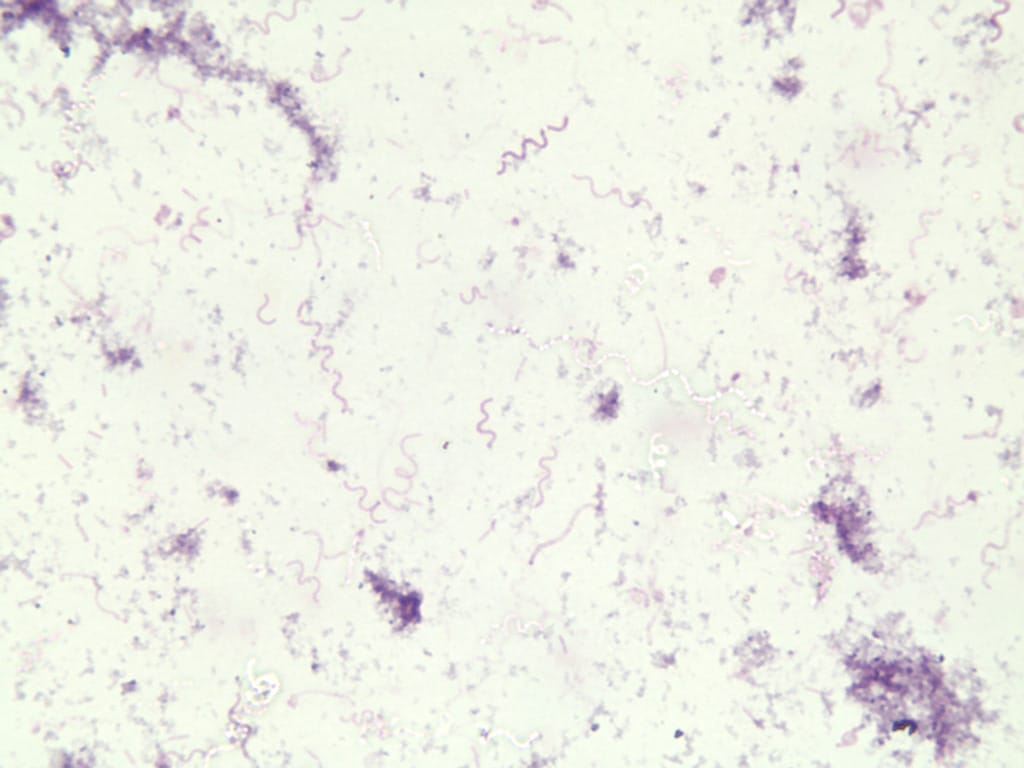 Spirillum volutans Slide