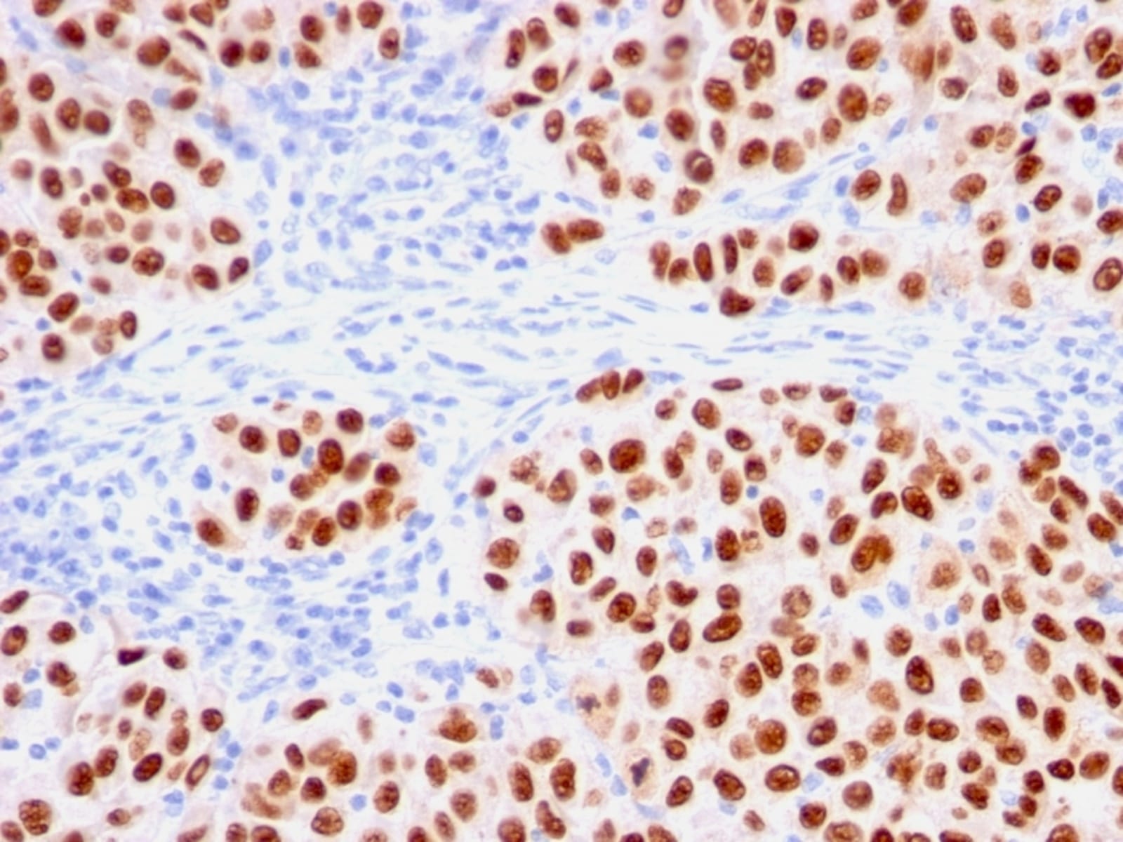 Anti-SOX10 Mouse Recombinant Antibody [clone: rSOX10/1074] | VWR, part ...