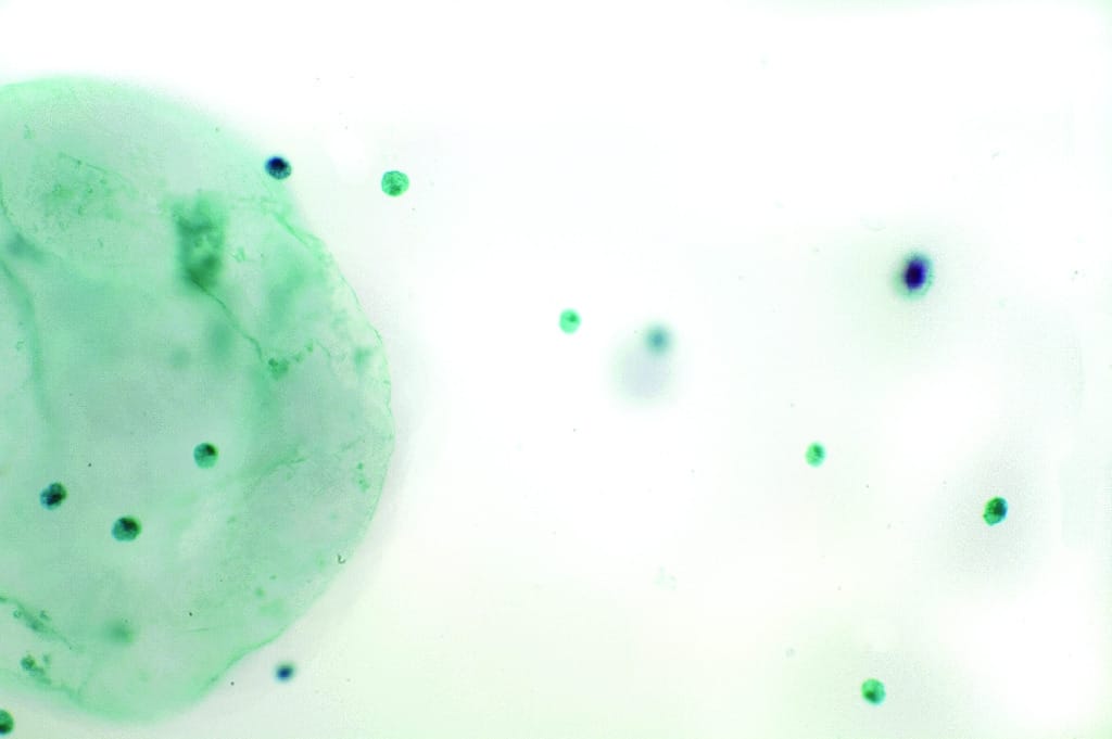 Scenedesmus Slide