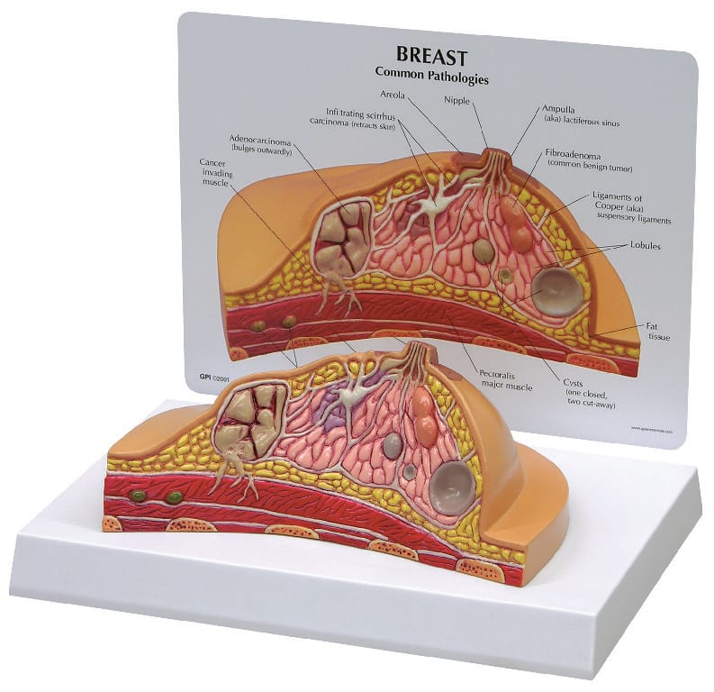 GPI Anatomicals® Basic Breast Cross Section Model