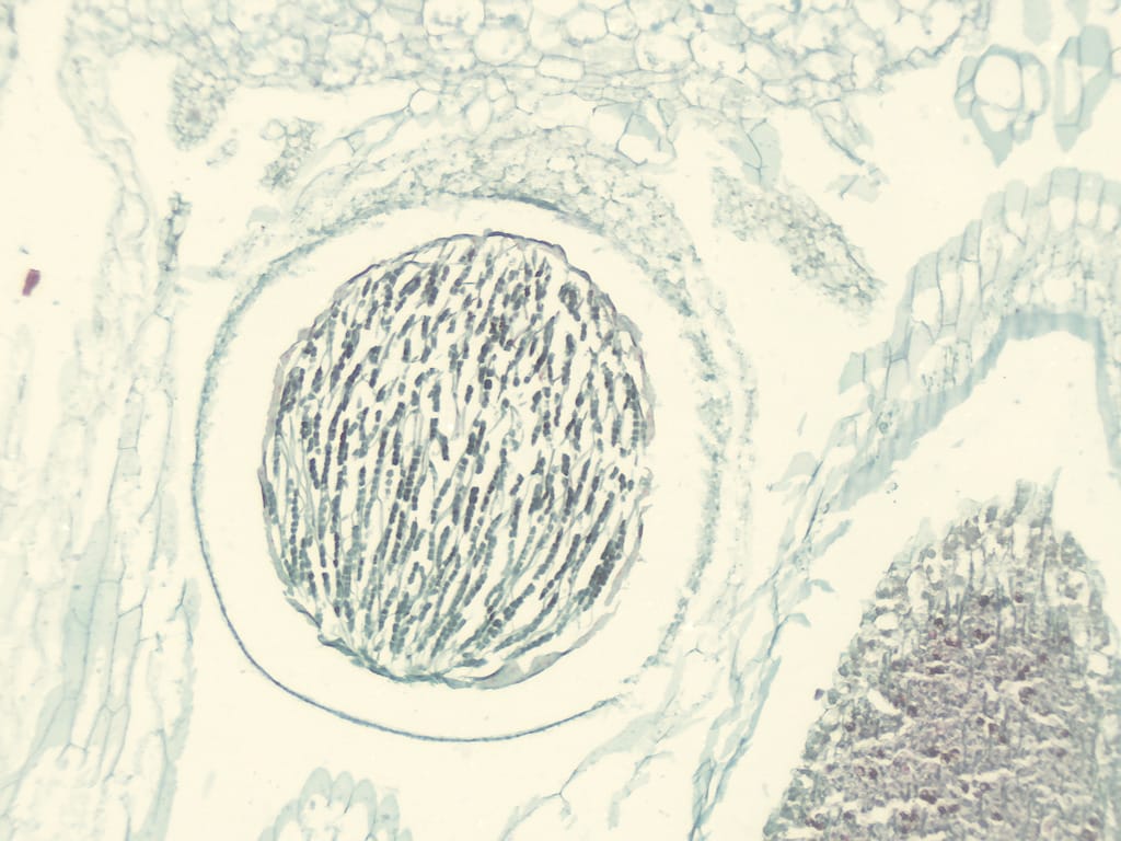Ward's® Liverwort (Marchantia) Slides