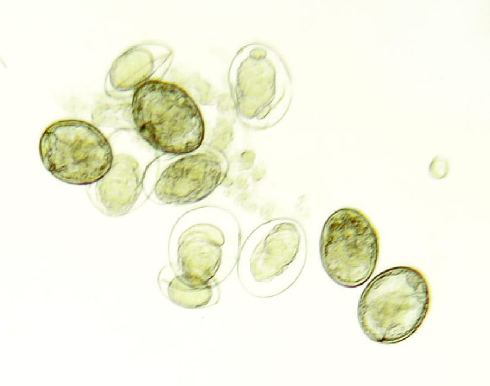 Schistosoma japonicum, Eggs Slide