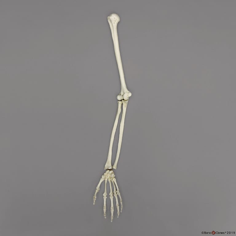 BoneClones® Limbs for Anatomical Comparison