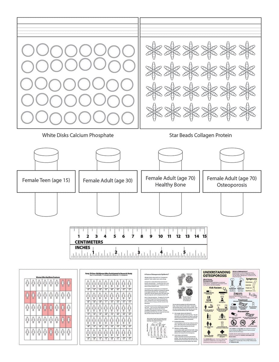 Science Take-Out® Brittle Bones: A Density Problem