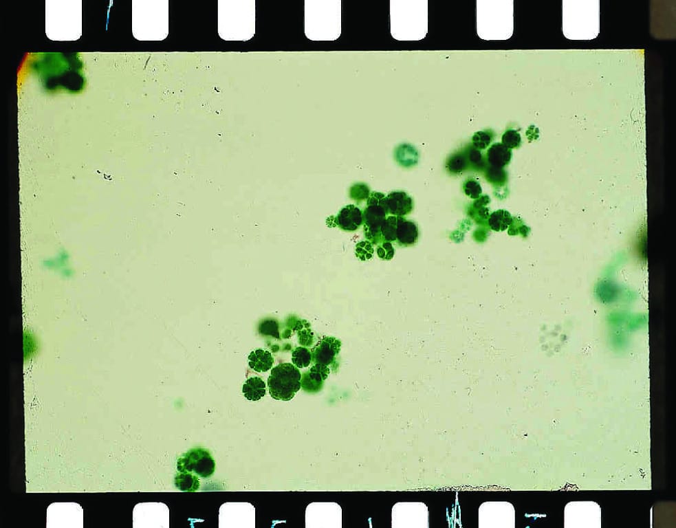 Eudorina Slide