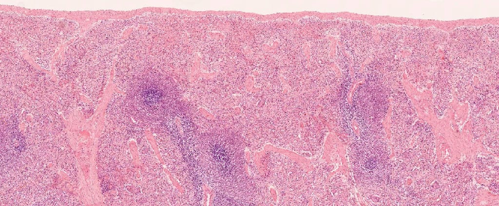 Spleen, Mammal Slide