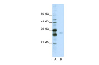 Anti-SRSF1 Rabbit Polyclonal Antibody