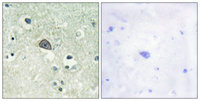 Anti-GRIN1 Rabbit Polyclonal Antibody