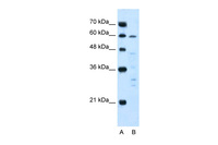 Anti-IL10RA Rabbit Polyclonal Antibody