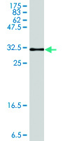 Anti-AKR1B10 Mouse Polyclonal Antibody