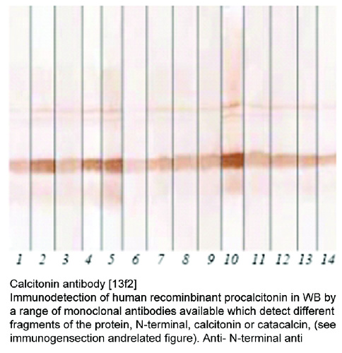 Mouse Monoclonal antibody to Calcitonin (calcitonin-related polypeptide alpha)