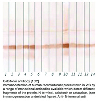 Anti-CALCA Mouse Monoclonal Antibody [clone: 13f2]