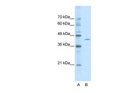 Anti-ZBTB26 Rabbit Polyclonal Antibody