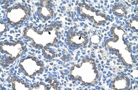 Anti-UBE2D2 Rabbit Polyclonal Antibody