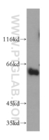 Anti-SYT3 Rabbit Polyclonal Antibody