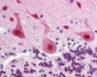 Anti-FANCA Rabbit Polyclonal Antibody