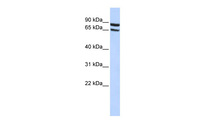 Anti-SLC6A15 Rabbit Polyclonal Antibody