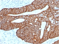Anti-Cytokeratin 18 Rabbit Recombinant Antibody [clone: KRT18/2819R]
