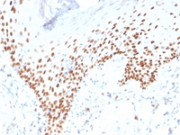 Anti-p40 Mouse Recombinant Antibody [clone: rTP40/3690]
