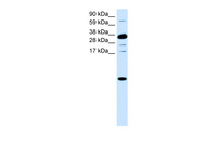 Anti-CXCL1 Rabbit Polyclonal Antibody