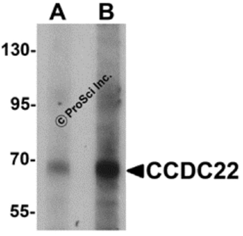 CCDC22 antibody